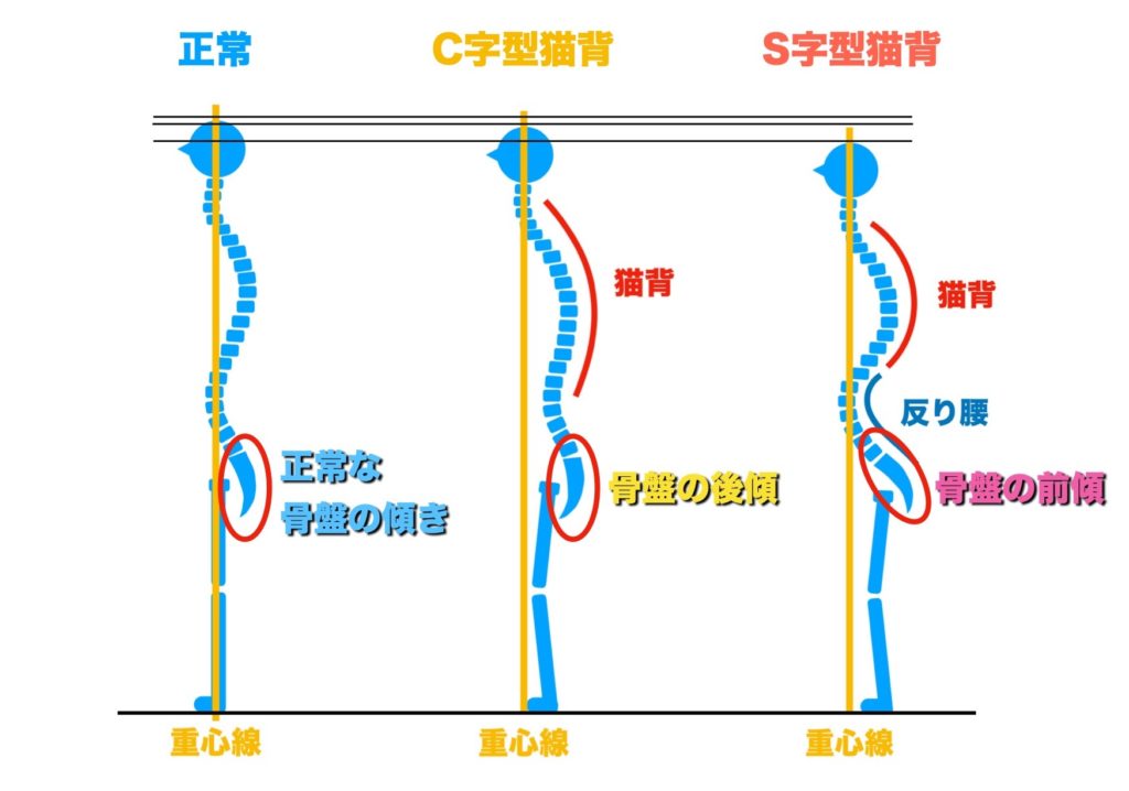 正しい姿勢と骨盤