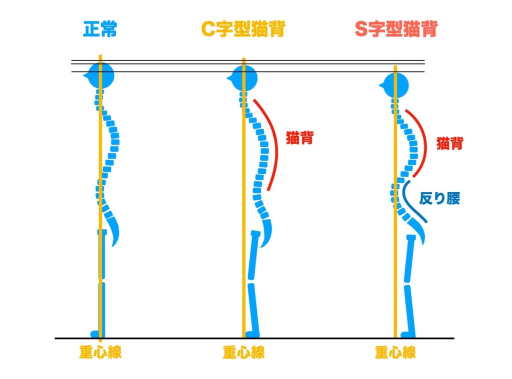 正しい姿勢と猫背